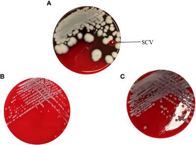 Persistent ciprofloxacin exposure induced the transformation of Klebsiella pneumoniae small colony variant into mucous phenotype